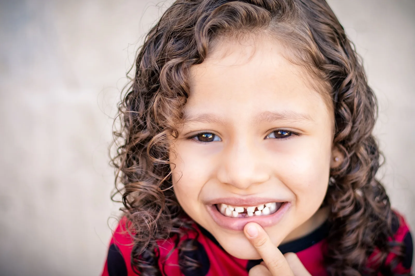 Broken or chipped tooth dental assessment in Blackburn North