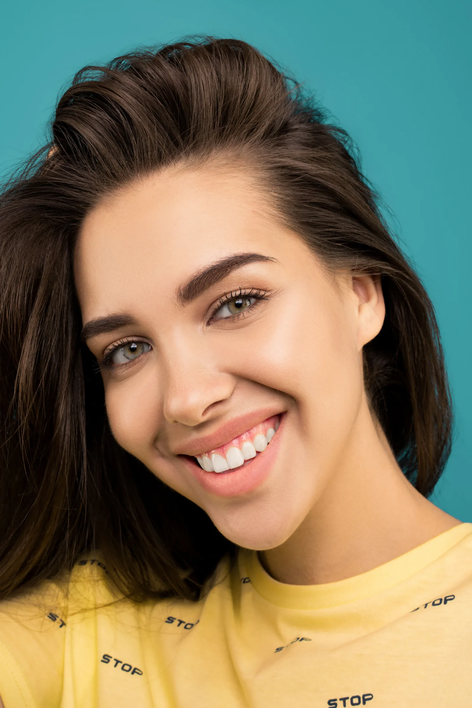 Gummy Smile at Relax Dental and Facial Care