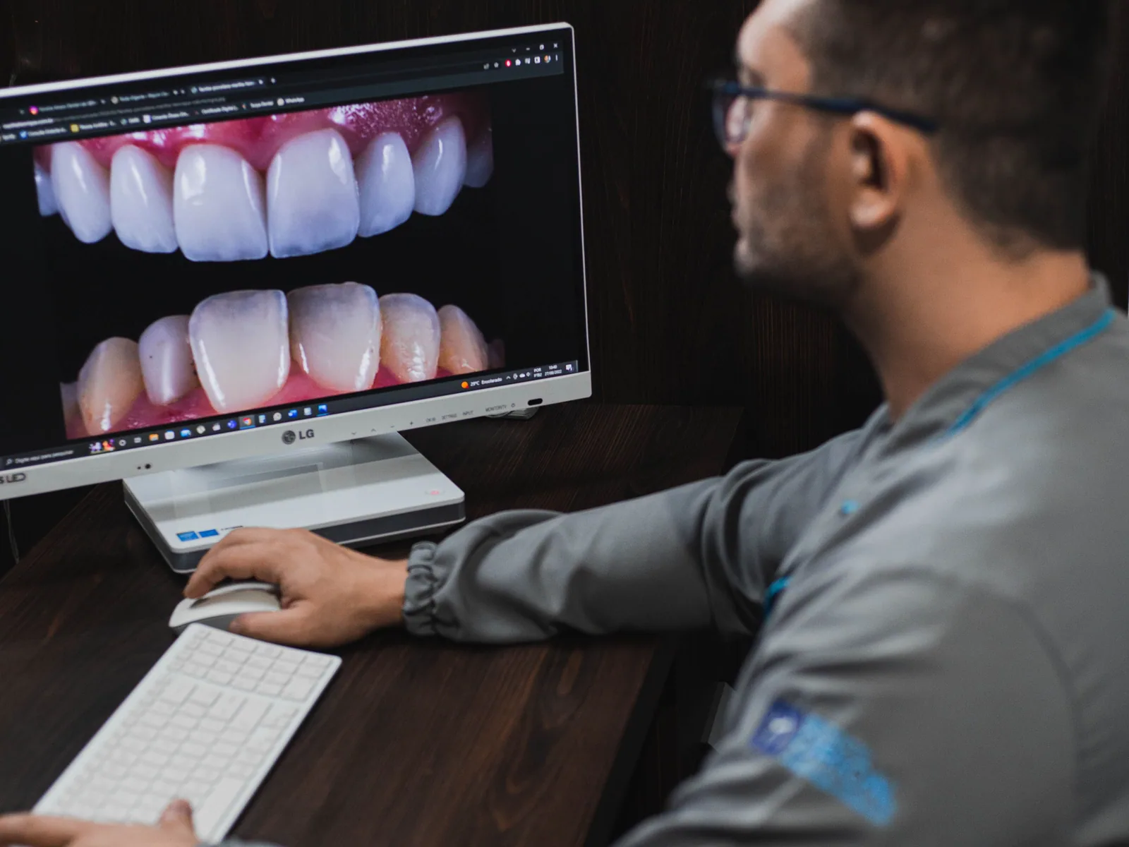 Porcelain veneers and crowns smile design consultation in Blackburn North
