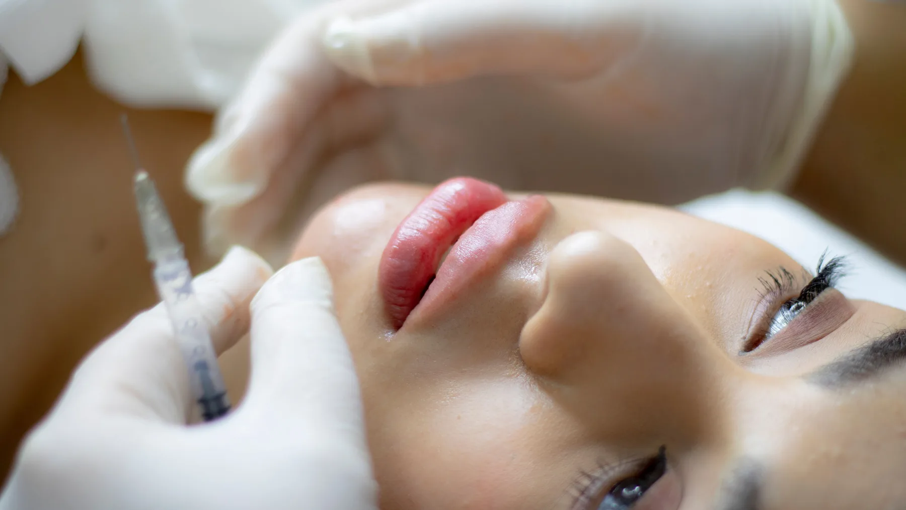 Volume & Contour Consultation at Relax Dental and Facial Care