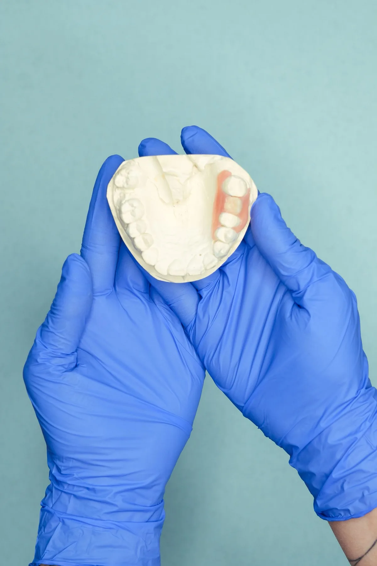 Partial denture model for missing teeth consultation in Blackburn North