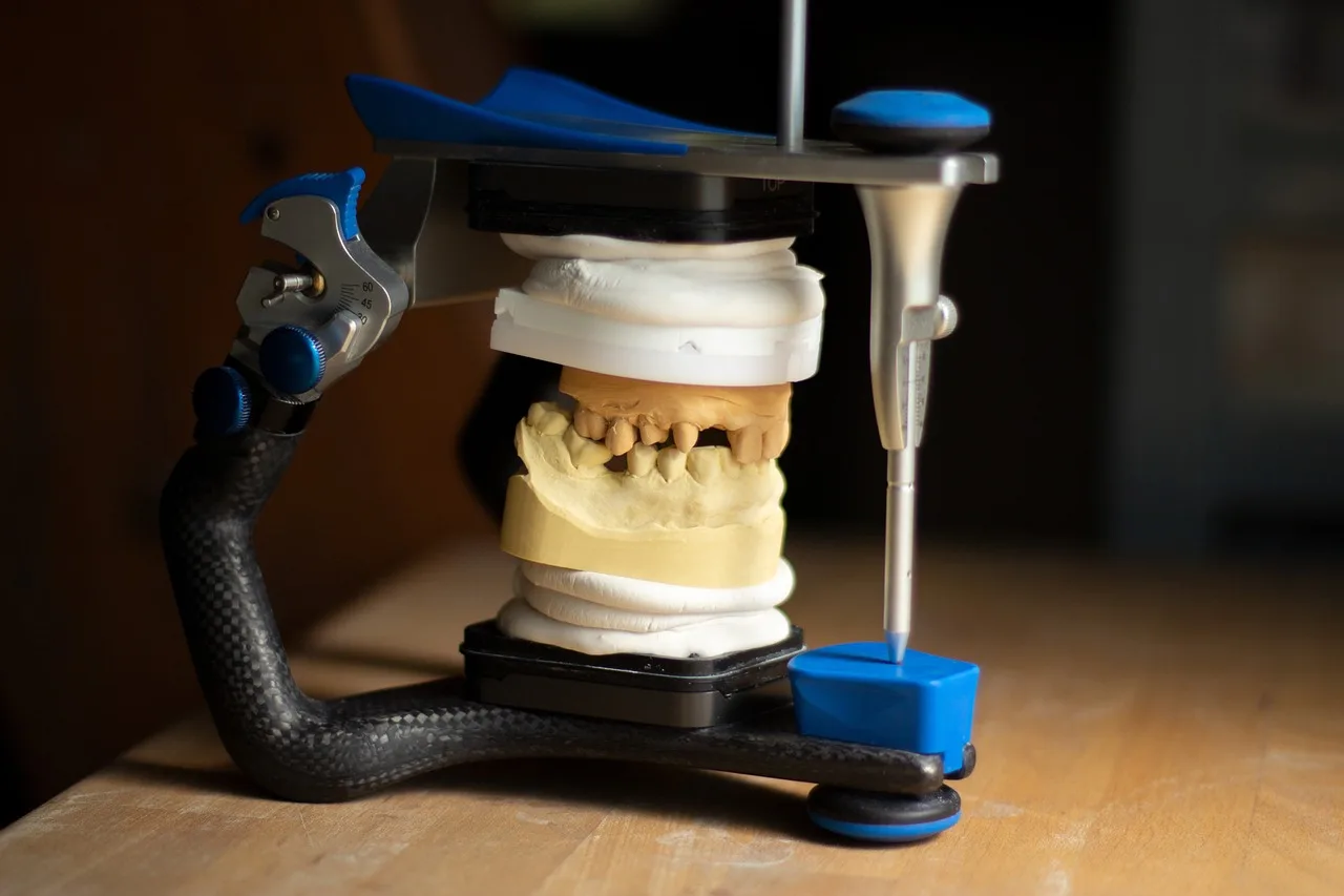 Implant-retained denture and tooth replacement options discussed in Blackburn North