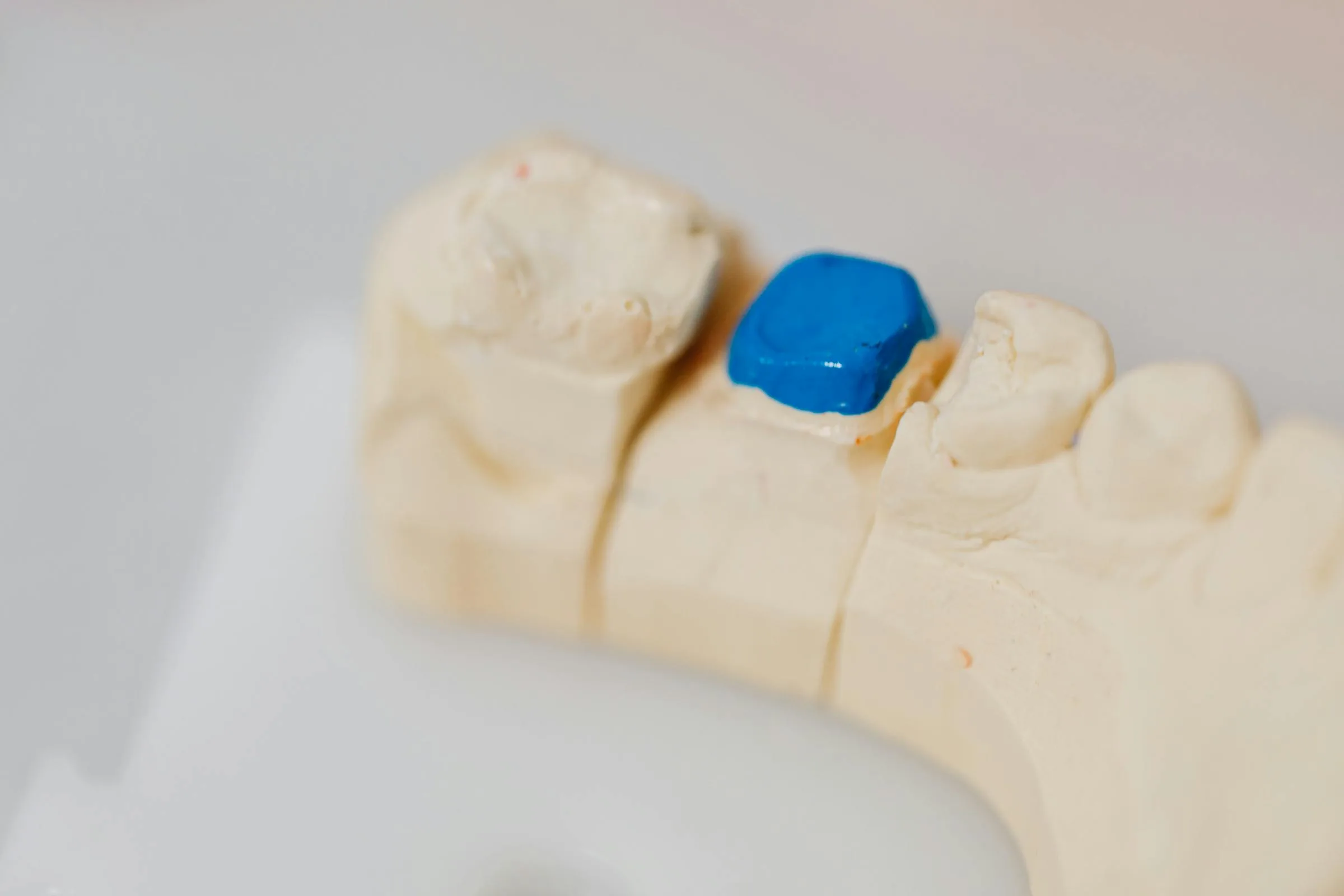 Tooth repair model for restorative dental care in Blackburn North